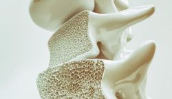Dores nas costas podem ser um indício de osteoporose entre os idosos